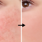 Niacinamide, l'actif des crèmes hydratantes qui fait fureur, mais pourquoi?