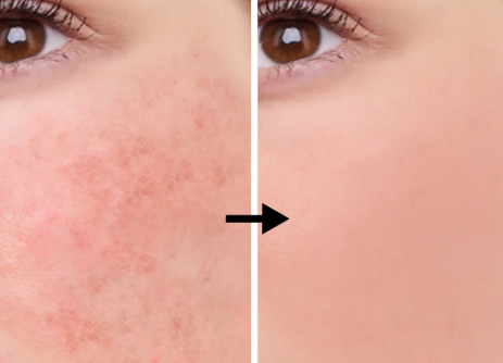 Niacinamide, l'actif des crèmes hydratantes qui fait fureur, mais pourquoi?